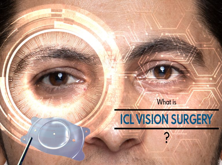 What is ICL Vision Surgery & How is it Performed?| Benefits & Risks of ICL Vision Surgery