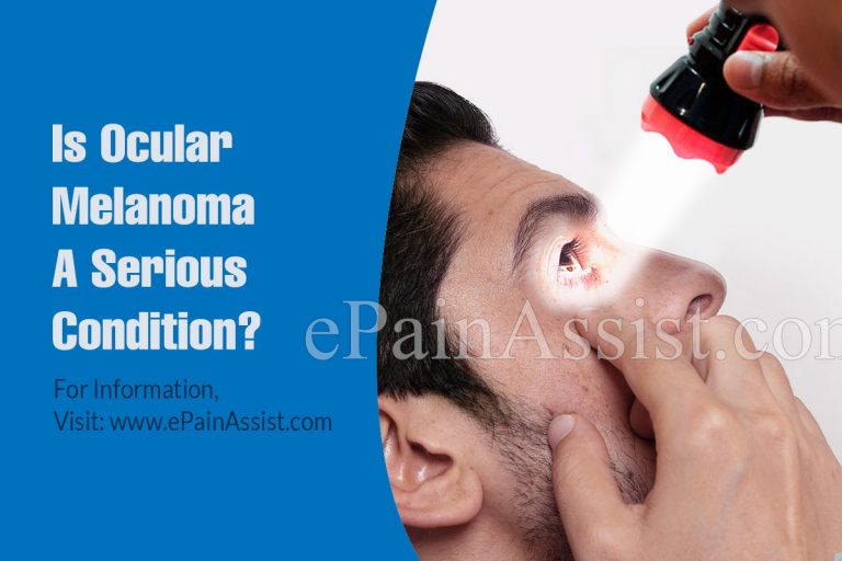 Is Ocular Melanoma A Serious Condition & Can It Be Reversed?