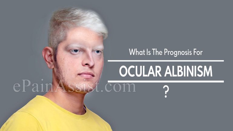 What Is The Prognosis For Ocular Albinism & Lifestyle Changes For It?