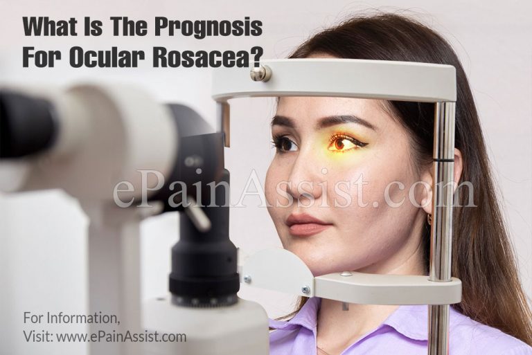 What Is The Prognosis For Ocular Rosacea & Lifestyle Changes For It?