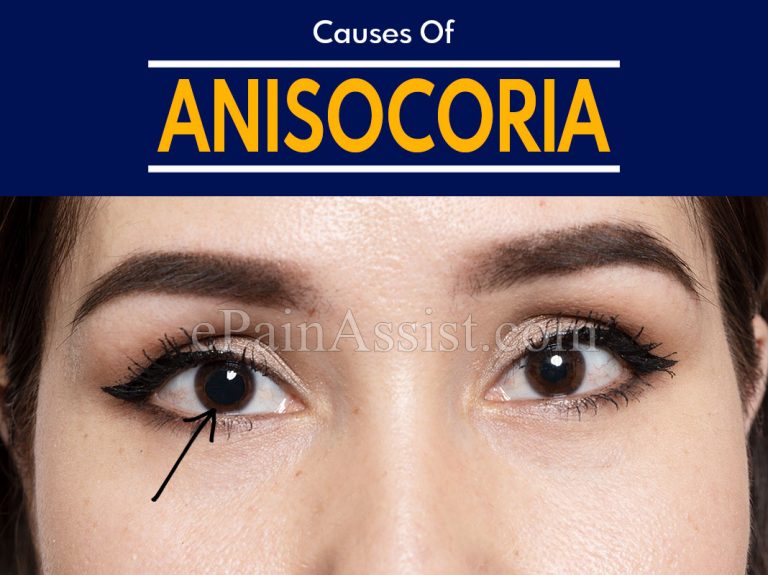 What Are The Causes Of Anisocoria?