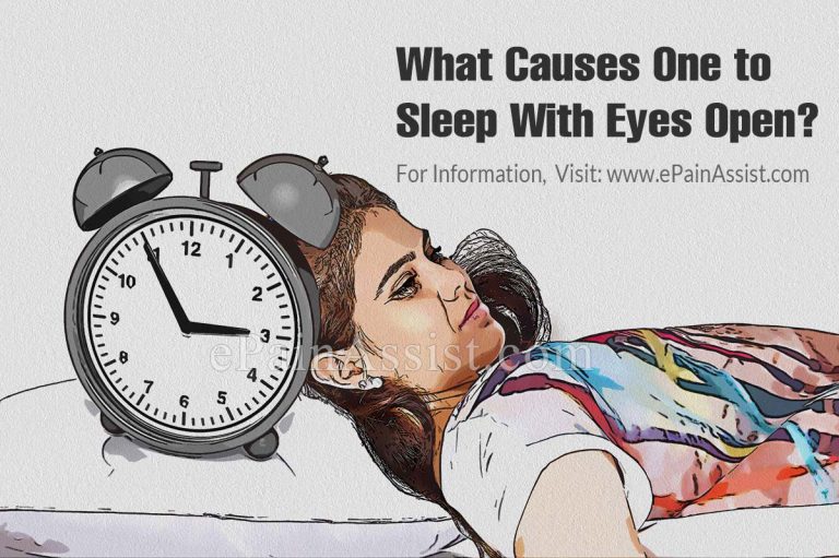 What Causes One to Sleep With Eyes Open