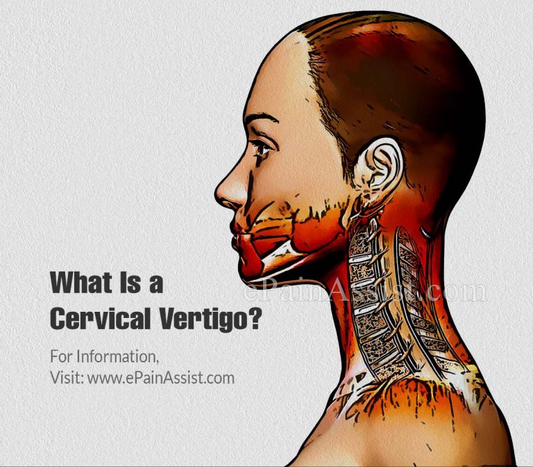 What is a Cervical Vertigo, Know its Causes, Treatment and Prevention