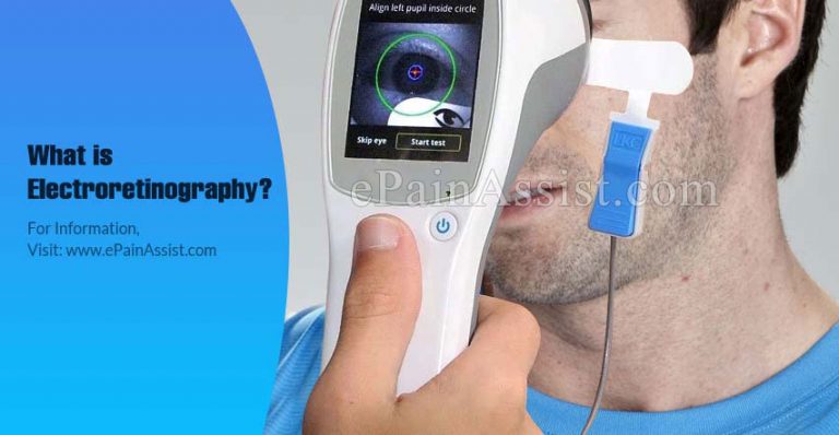 What is Electroretinography?