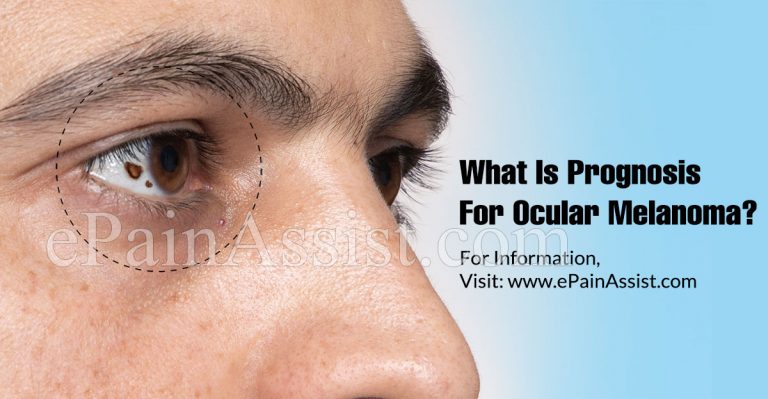 What Is Prognosis For Ocular Melanoma & Lifestyle Changes For It?