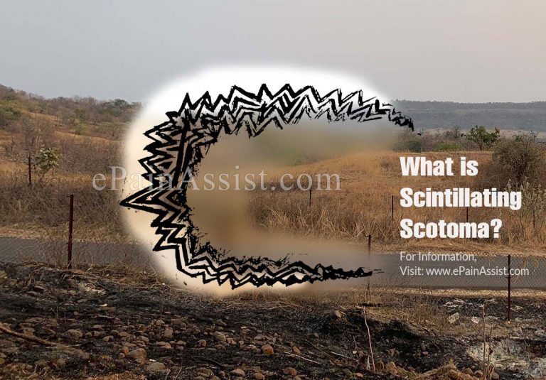 What is Scintillating Scotoma & How is it Treated?|Symptoms, Causes and Risk Factors of Scintillating Scotoma