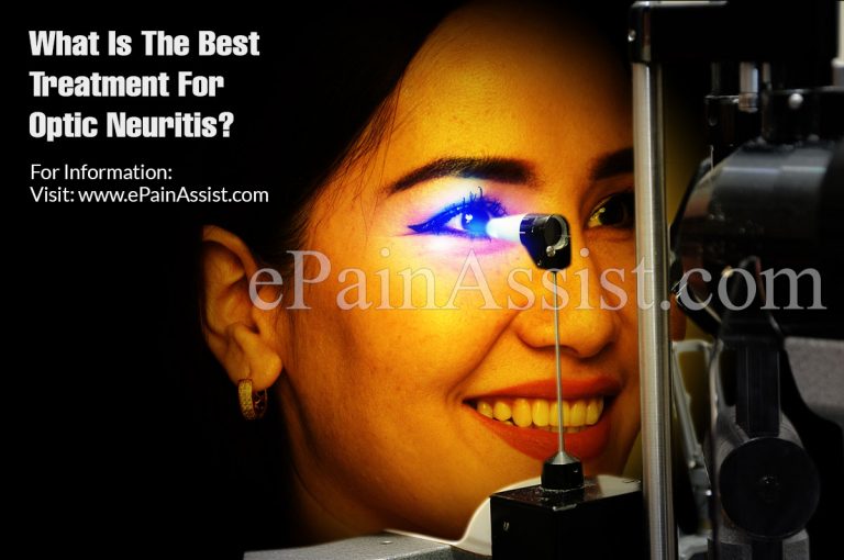 What Is The Best Treatment For Optic Neuritis?
