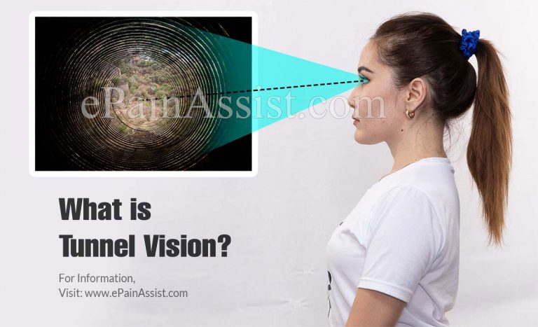 What are the Causes of Tunnel Vision, Its Symptoms & Treatment