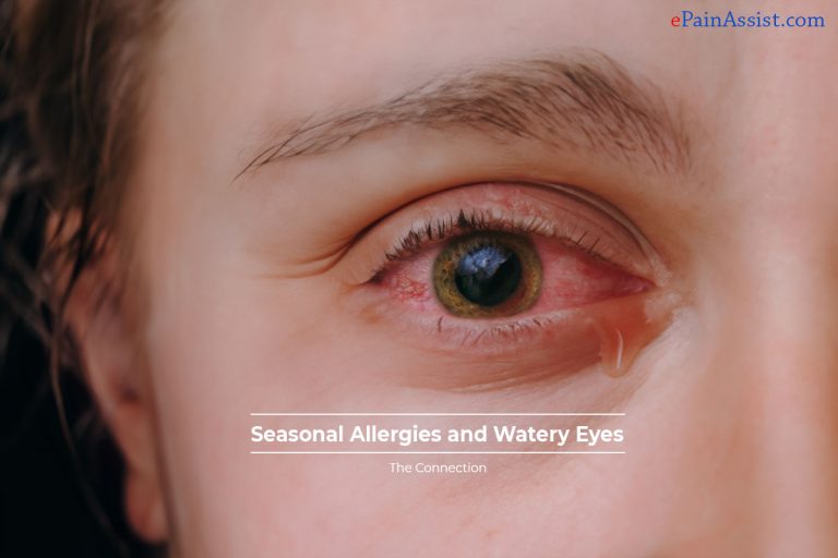 Decoding the Link: How Seasonal Allergies Trigger Watery Eyes – An In-Depth Guide