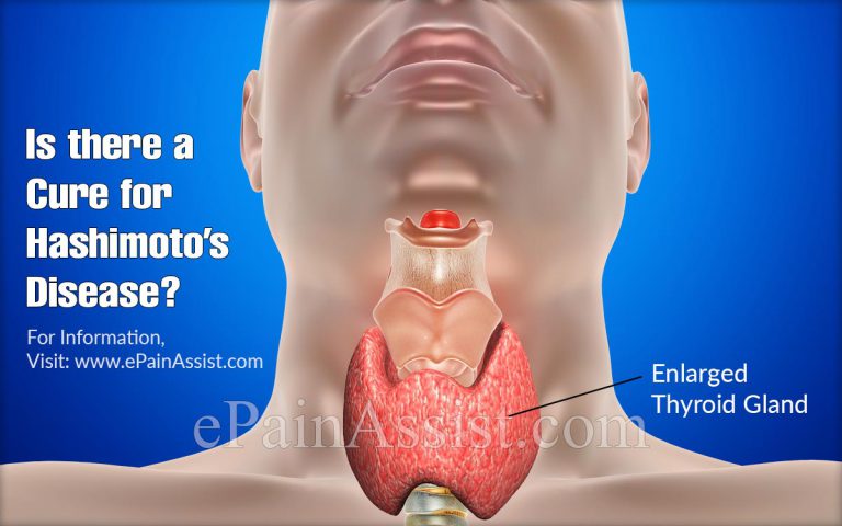 Is There A Cure For Hashimoto’s Disease?