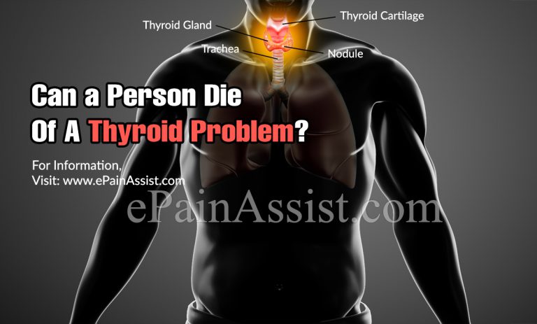 Can a Person Die Of A Thyroid Problem?