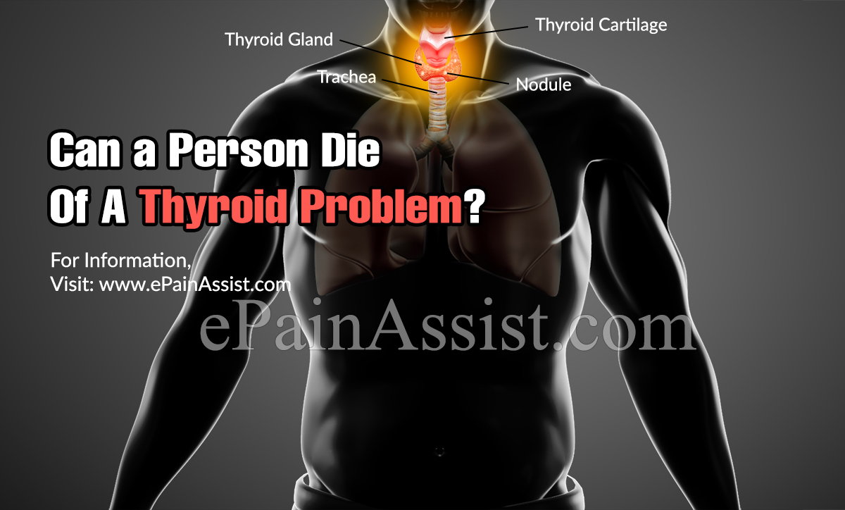 Can a Person Die Of A Thyroid Problem?