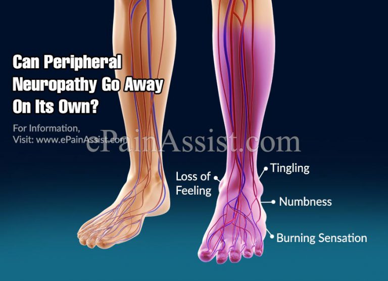 Can Peripheral Neuropathy Go Away On Its Own?