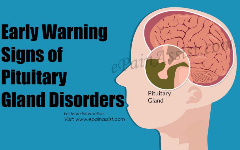 Early Warning Signs of Pituitary Gland Disorders & the Causes, Symptoms, Treatment of Pituitary Gland Disorders
