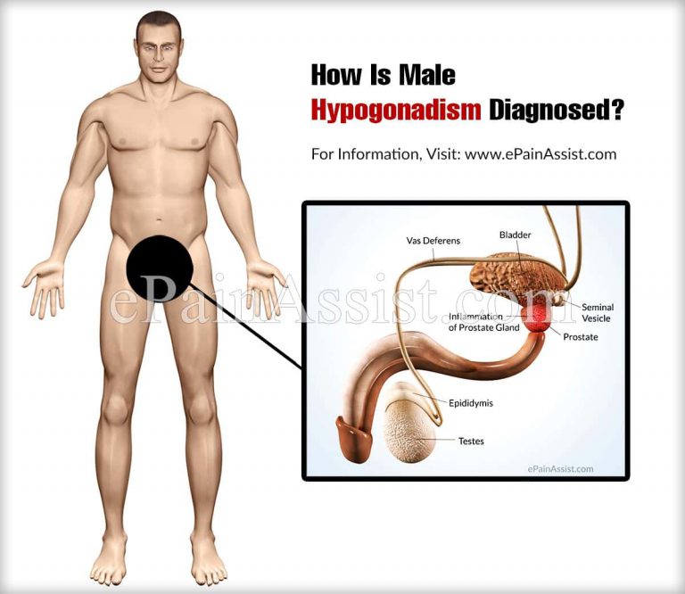 How Is Male Hypogonadism Diagnosed?