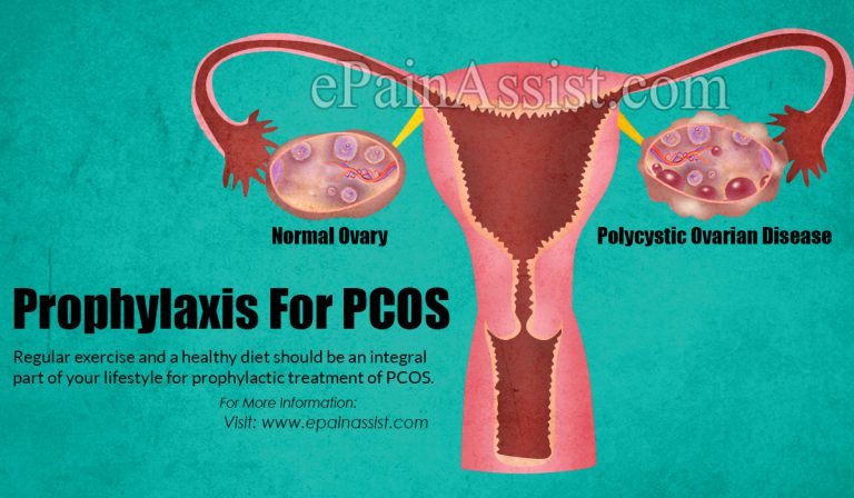 Prophylaxis For PCOS