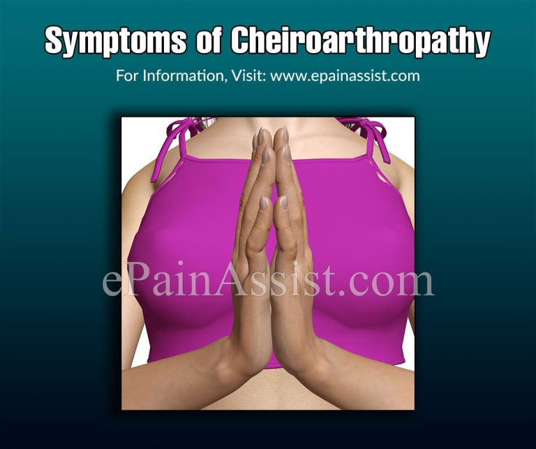 Cheiroarthropathy: Causes, Symptoms, Treatment