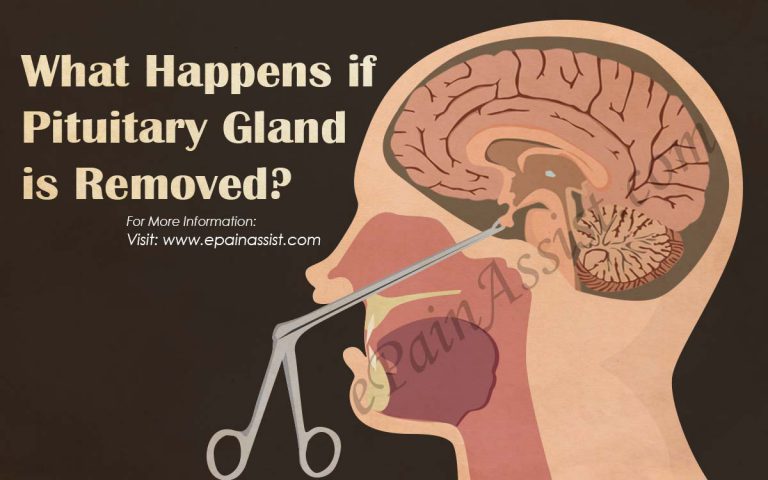 What Happens if Pituitary Gland is Removed?