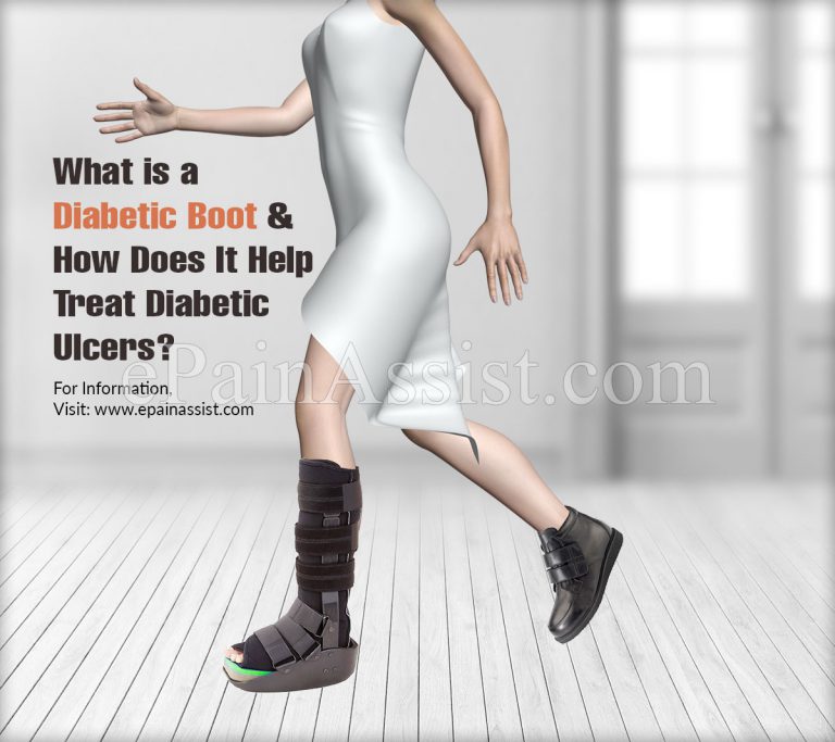 What is a Diabetic Boot & How Does It Help Treat Diabetic Ulcers?