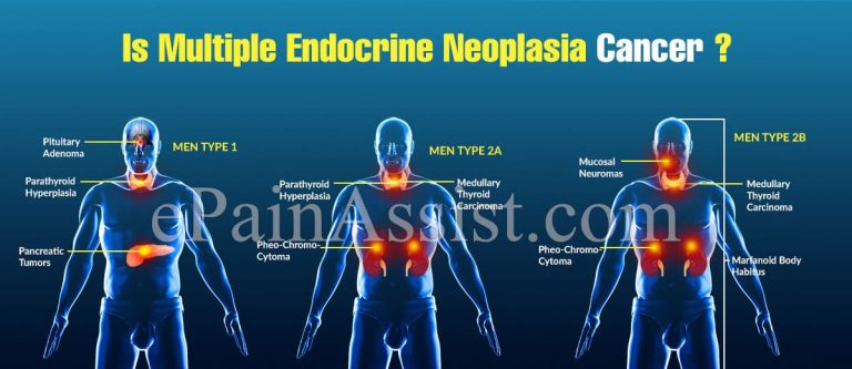 Is Multiple Endocrine Neoplasia Cancer?