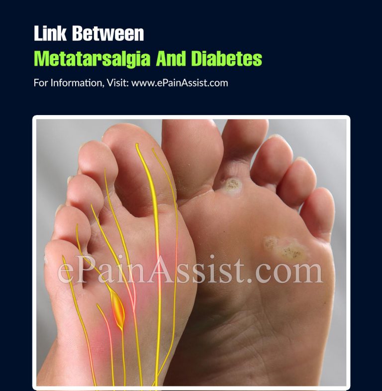 Link Between Metatarsalgia And Diabetes