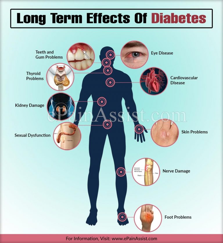 Long Term Effects Of Diabetes