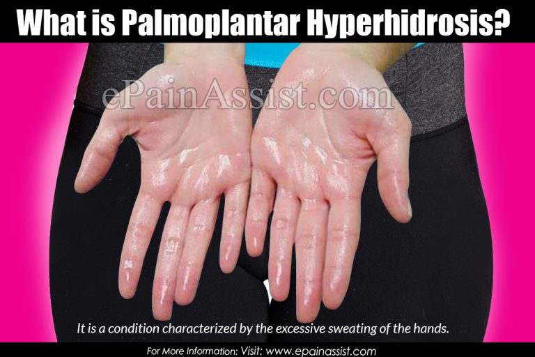 Palmoplantar Hyperhidrosis : Causes, Symptoms, Treatment, Complications, Diagnosis