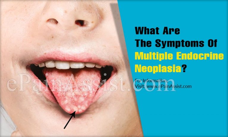 What Are The Symptoms Of Multiple Endocrine Neoplasia?