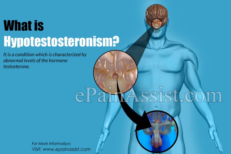 What is Hypotestosteronism : Causes, Symptoms, Treatment, Prognosis, Prevention