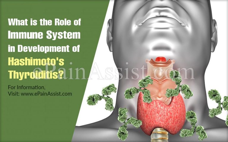 What is the Role of Immune System in Development of Hashimoto’s Thyroiditis?