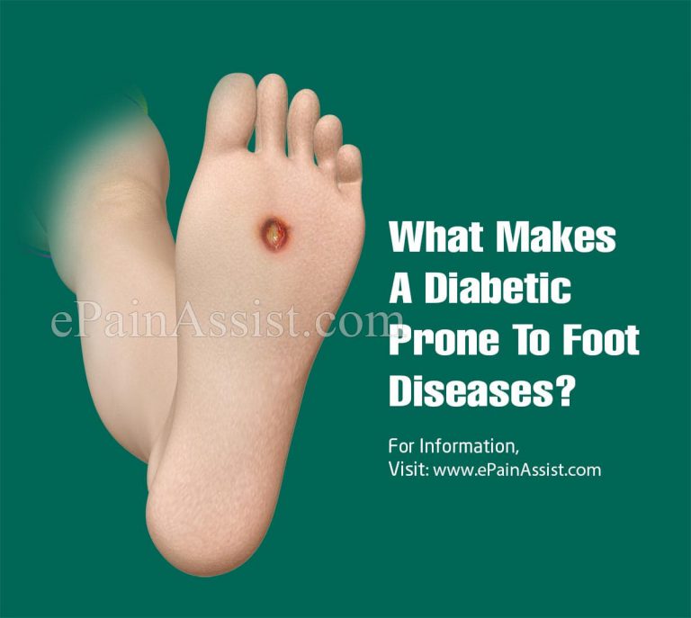 What Makes A Diabetic Prone To Foot Diseases?| Signs, Symptoms, Care & Prognosis of Foot Disease In Diabetics