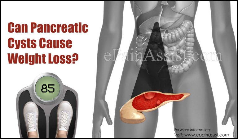 Can Pancreatic Cysts Cause Weight Loss & Can They Be Drained?