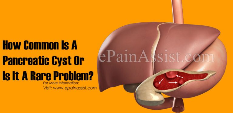 How Common Is A Pancreatic Cyst Or Is It A Rare Problem?