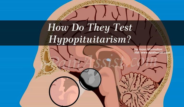 How Do They Test For Hypopituitarism & Can Hypopituitarism Be Cured?