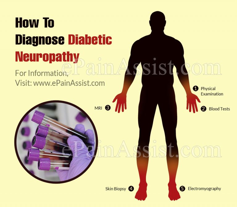 How To Diagnose Diabetic Neuropathy & What Is The Best Medicine For It?