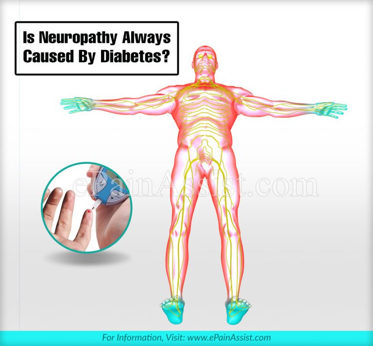 Is Neuropathy Always Caused By Diabetes?