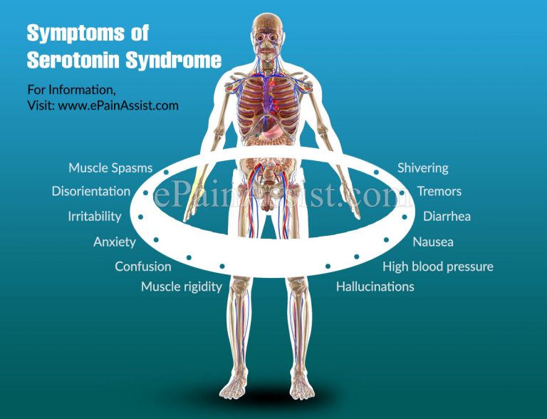 Serotonin Syndrome: Causes, Symptoms, Treatment, Complications, Diagnosis