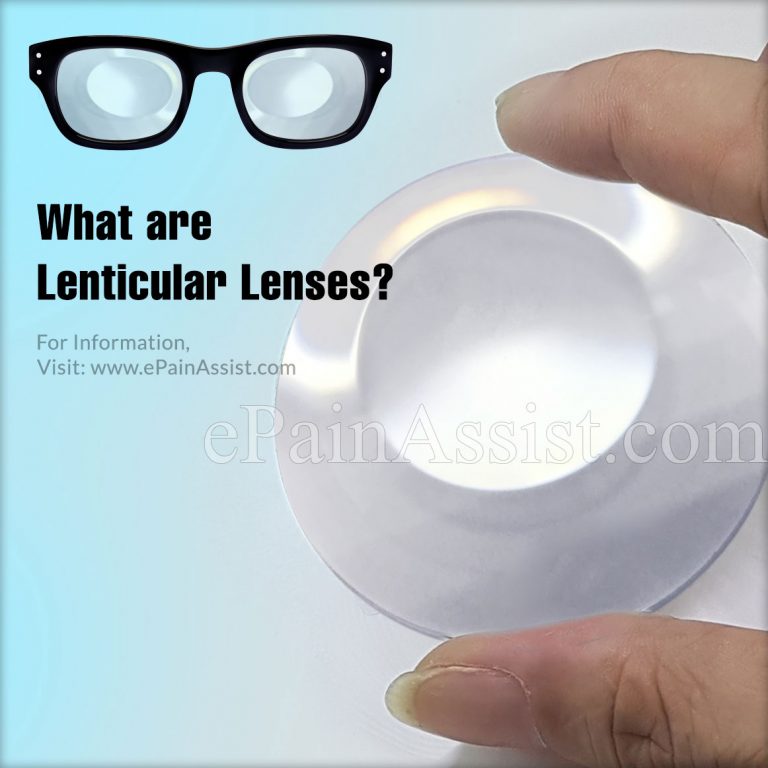 What are Lenticular Lens, Know its Types, Benefits, Advantages