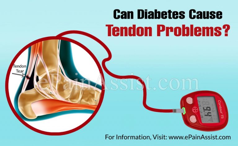 Can Diabetes Cause Tendon Problems?