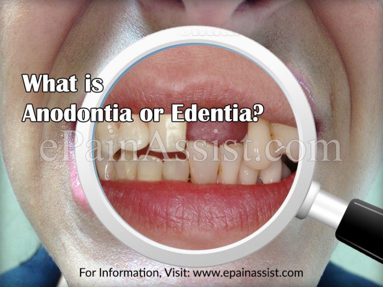 Anodontia or Edentia: Causes, Treatment, Diagnosis