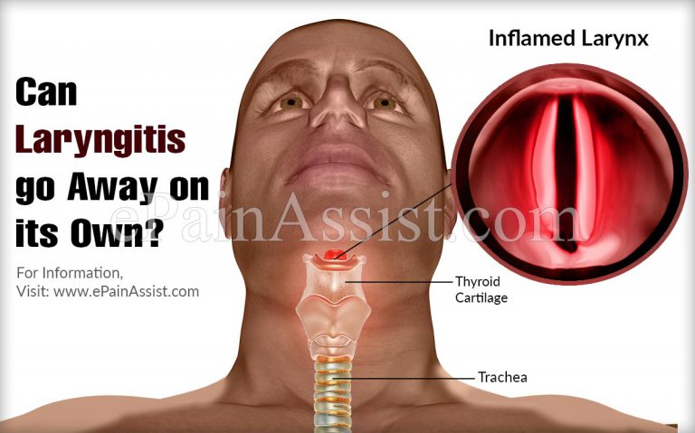 Can Laryngitis Go Away On Its Own?