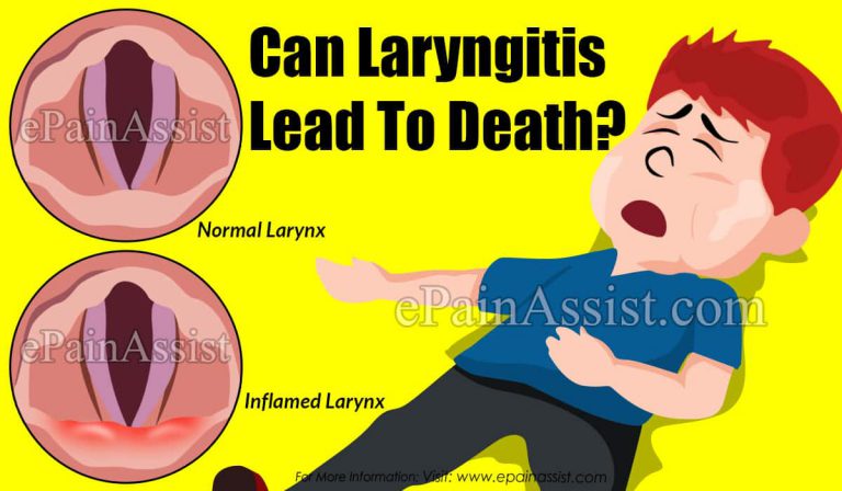 Can Laryngitis Lead To Death?