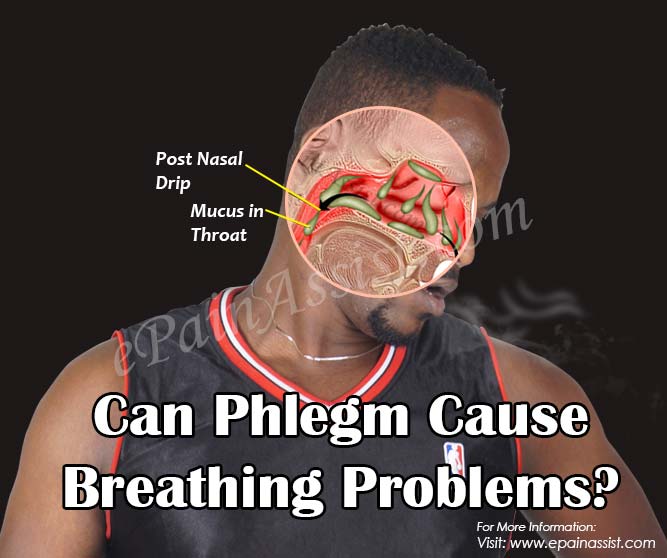 Can Phlegm Cause Breathing Problems? Can Phlegm Cause Breathing Problems?