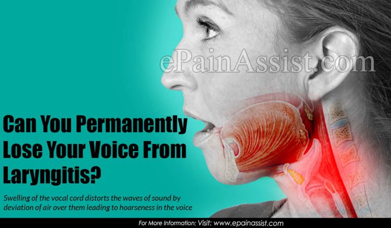 Can You Permanently Lose Your Voice From Laryngitis?