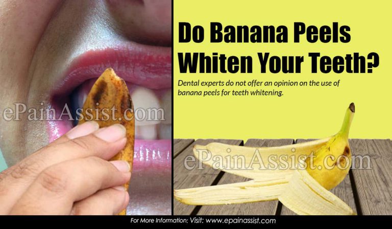 Do Banana Peels Whiten Your Teeth?
