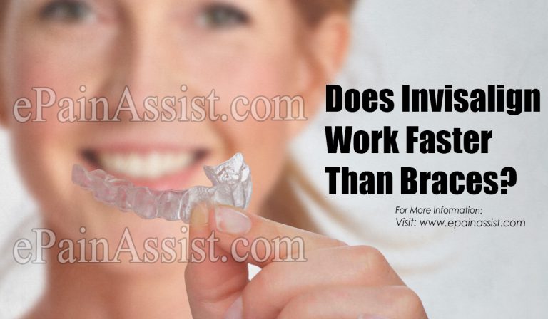 Does Invisalign Work Faster Than Braces?
