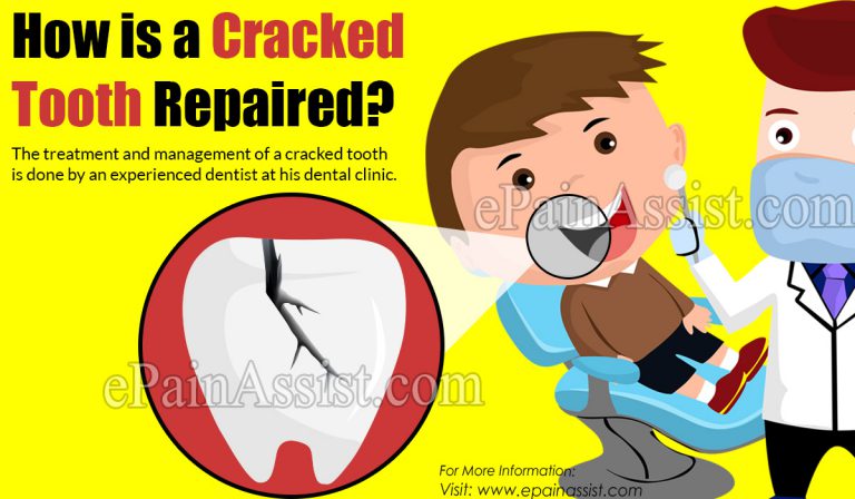 How is a Cracked Tooth Repaired?
