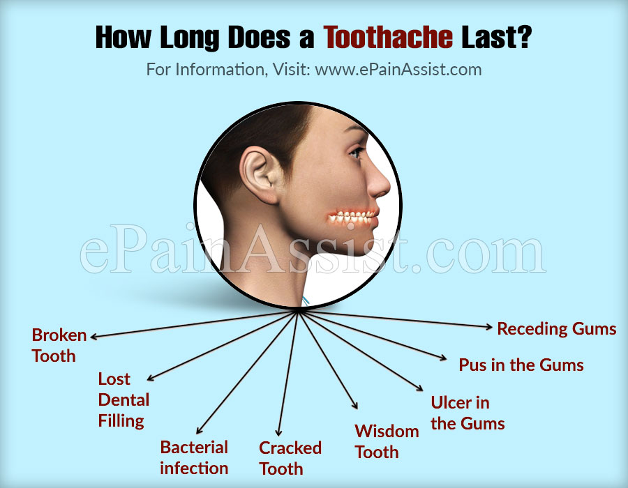 How Long Does A Toothache Last & The Best Painkillers For Toothaches?