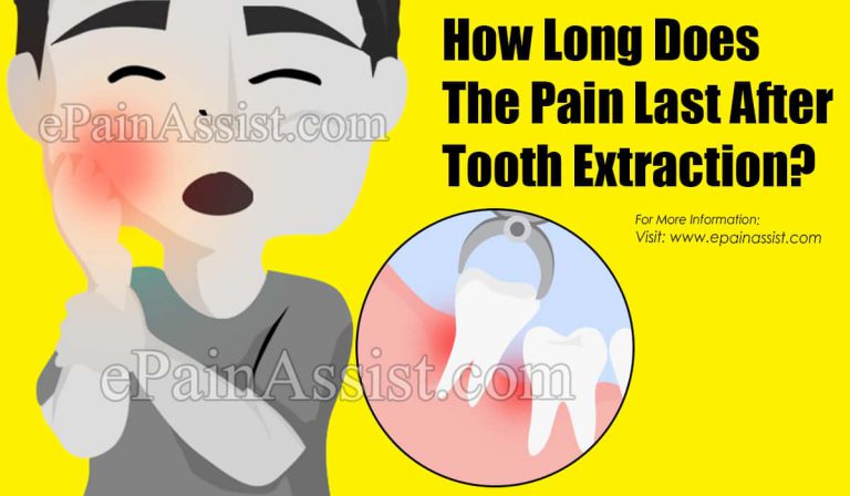 How Long Does The Pain Last After Tooth Extraction?