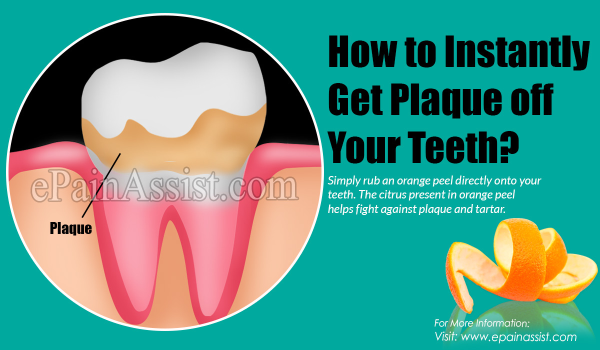 How to Instantly Get Plaque off Your Teeth?